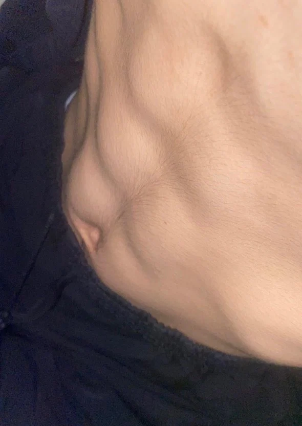 Toontoon