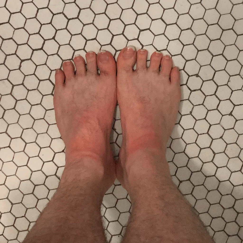 Feet Chicago