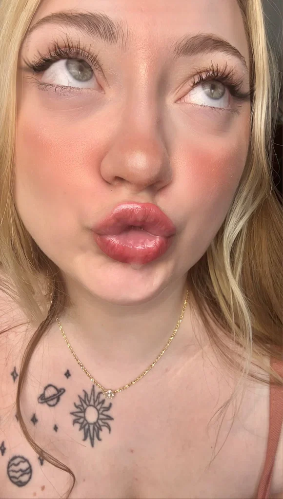 Brat Berry