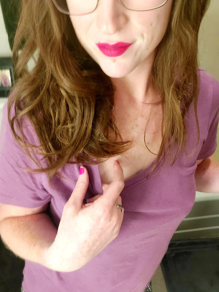 Redfoxgreeneyes