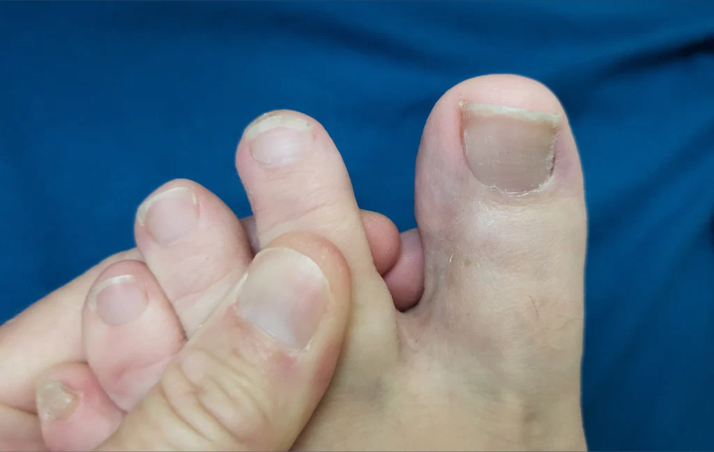 Toetheline