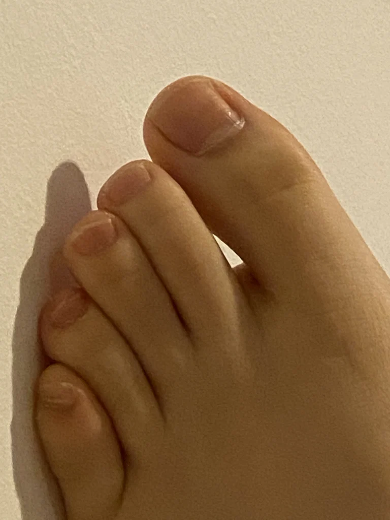 juicytoe
