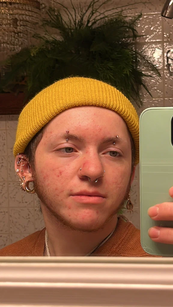 kade acacias
