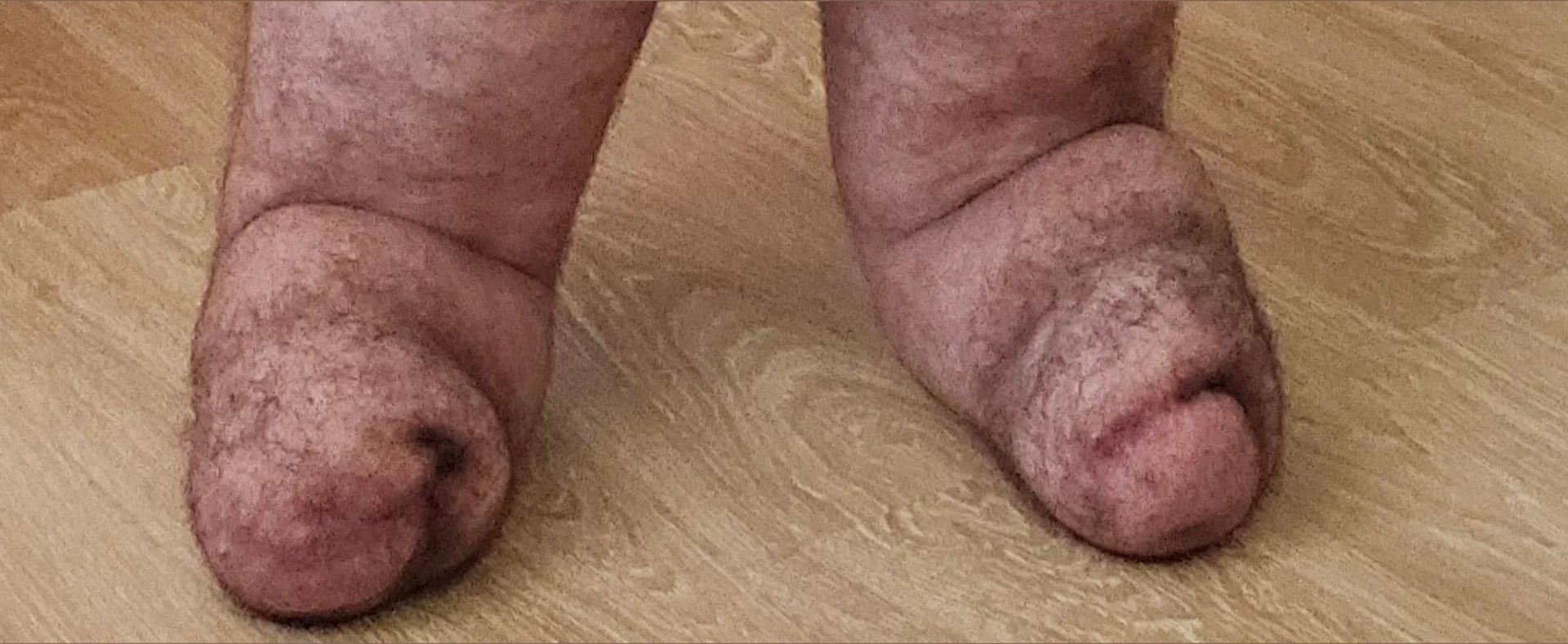 Amputee pup🍆🦿🦿 profile banner