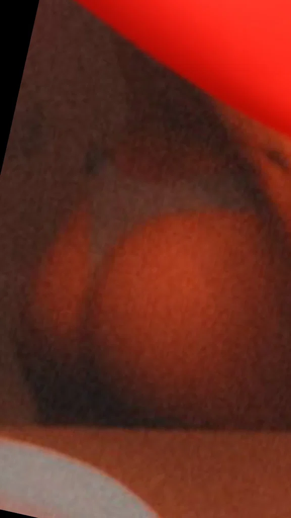 tete