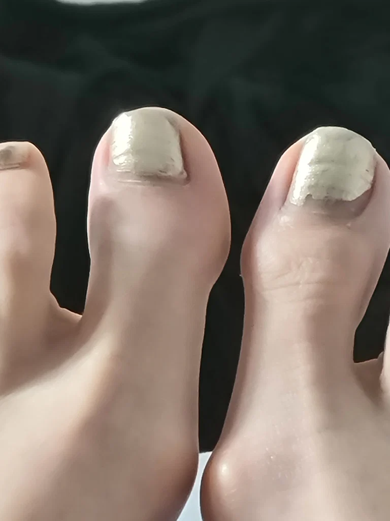 Grossfeet's avatar