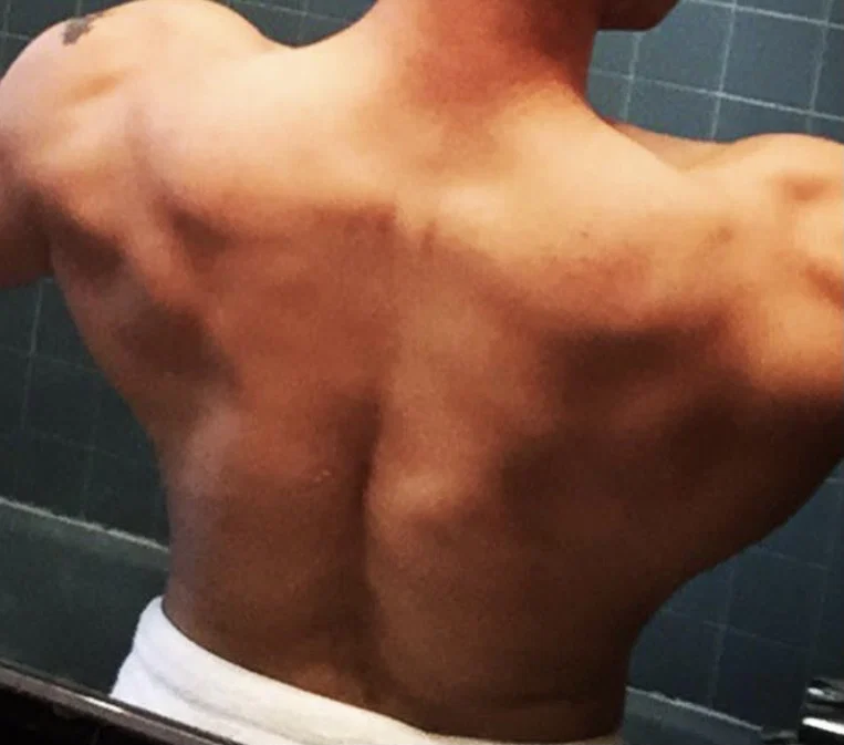Cheek-a-Leak