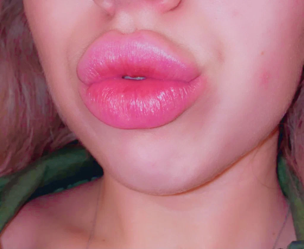 BigLips