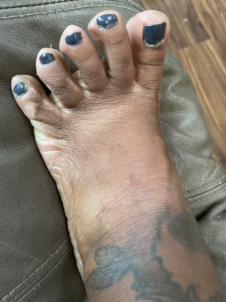 Ugly feet's avatar