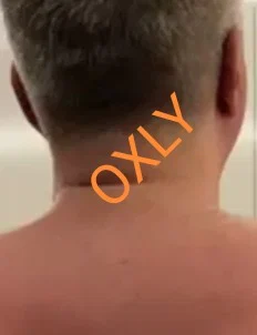 OXLY