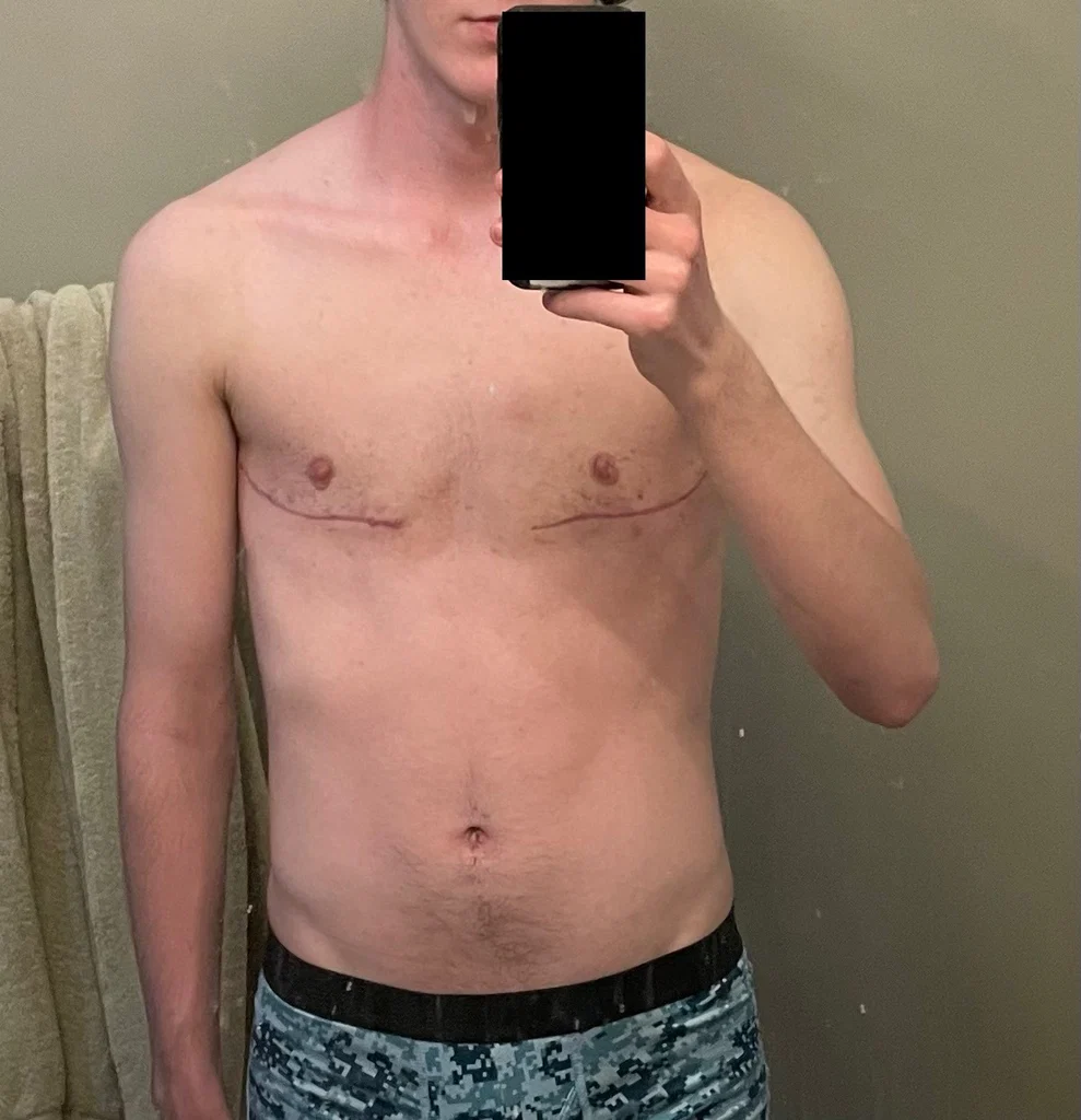 FTM Twink