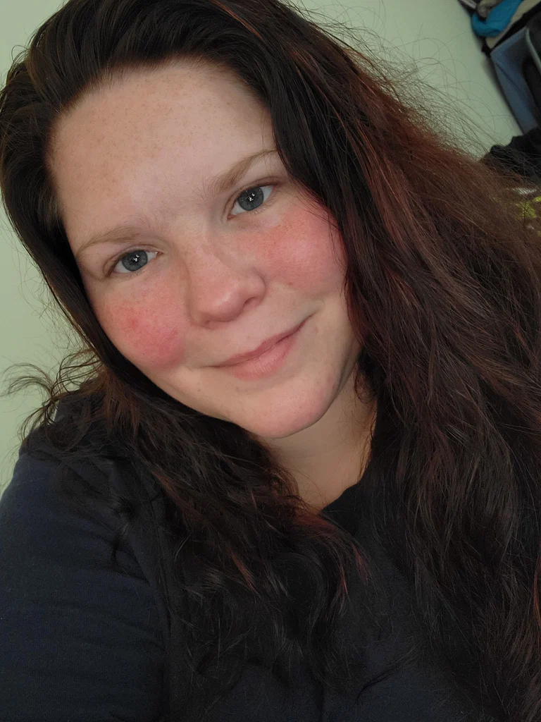 BeautifullyScarred