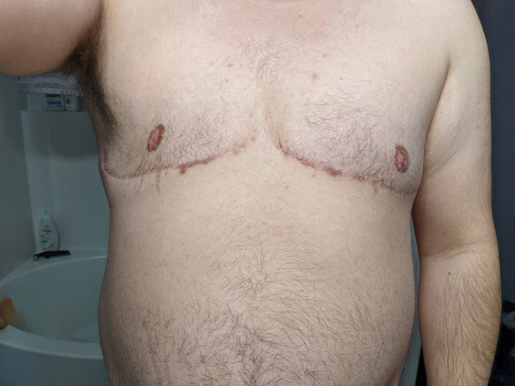 FTM Fun