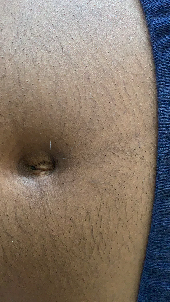 Hmu
