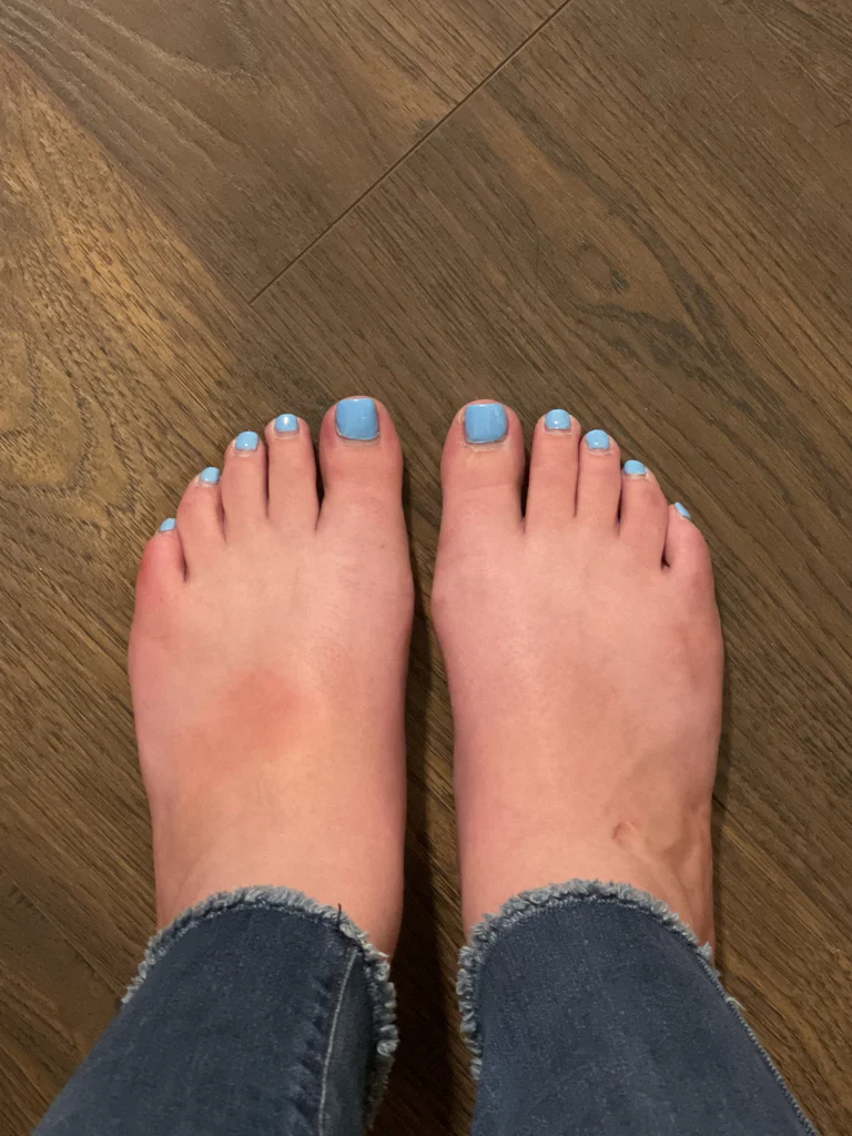 ToeHoe