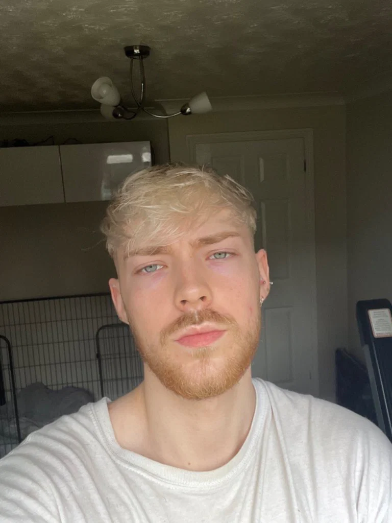Liam Austin (FREE ACCOUNT)