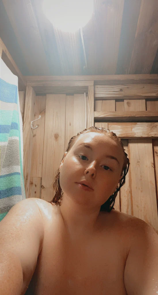 Freckles