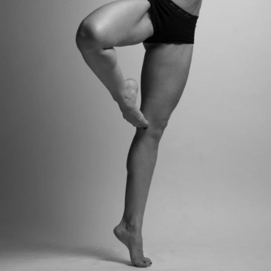 Legs