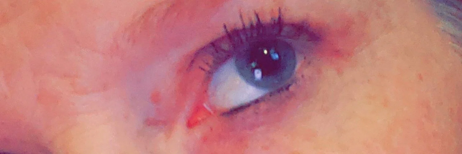 Freckleface profile banner